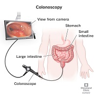 Colonoscopy Test Center In Delhi